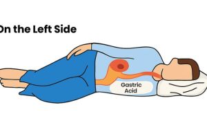 The Connection Between Left-Side Sleeping and Better Gut Health