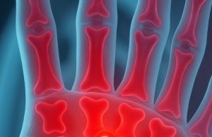 Vitamin Deficiencies That Can Cause Numbness